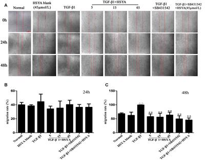 Hydroxysafflor Yellow A Suppresses MRC-5 Cell Activation Induced by TGF-β1 by Blocking TGF-β1 Binding to TβRII